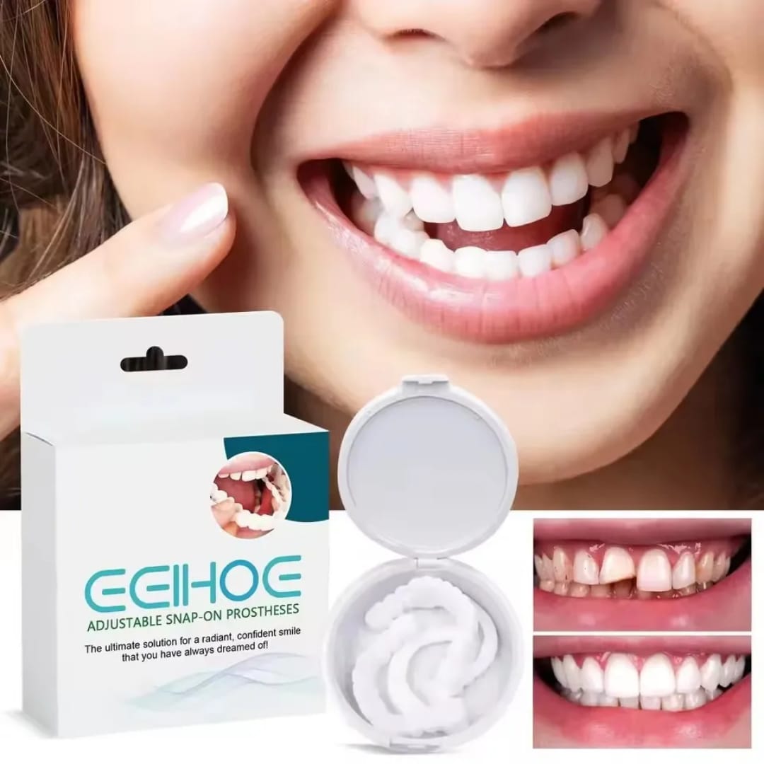 Prothèses dentaires Adjustable Snap-On Dentures